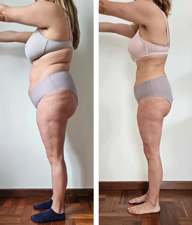 Antes y después real de una mujer del programa RevolucionaT